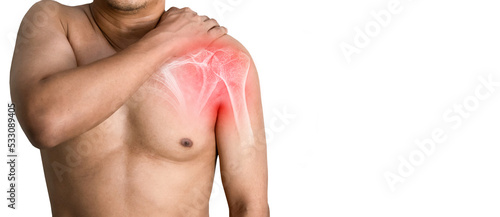 bone of human shoulder arm the inflamed photo