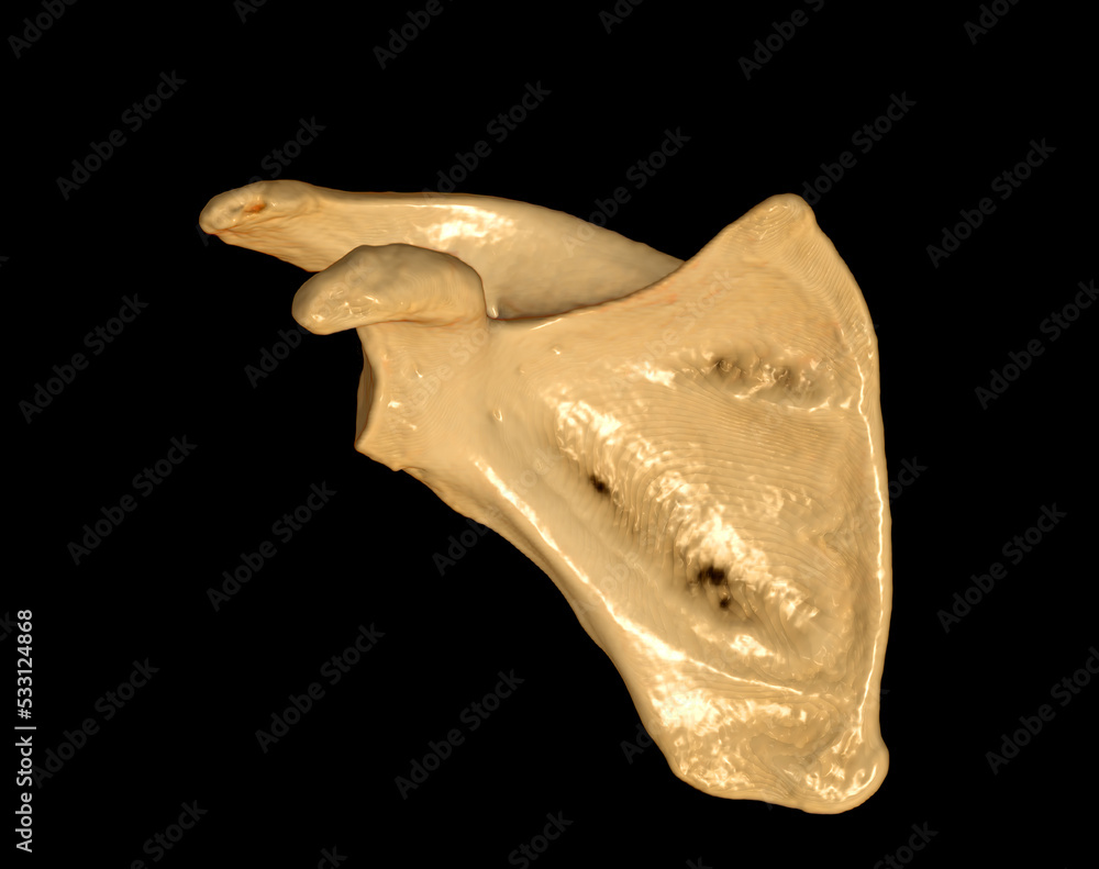 CT Shoulder 3D CT Shoulder 3D
