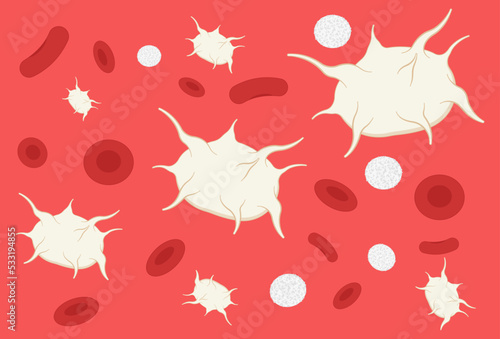 complete low platelet count reddish purple spots hepatitis C enlarged spleen alcoholism Alcohol use disorder Decreased AIDS HIV virus nosebleed hematuria bruises red blood cell