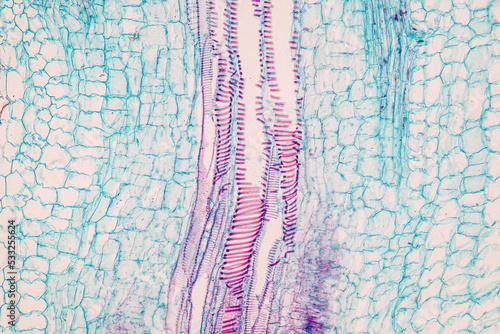 Plant tissue Structure, section (tissue) of stem plant tissue under a light microscope. photo