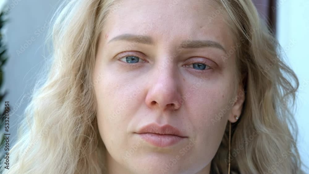 Portrait of tired sick woman with blue eyes looking into the camera. Woman has reddened eyelids and wet eyes. Girl looks tired and sad, going through grief. Watery eyes Portrait of tired sick woman with blue eyes looking into the camera. Woman has reddened eyelids and wet eyes. Girl looks tired and sad, going through grief. Watery eyes