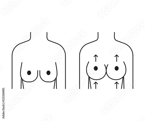 Woman breast lift, increase in size and reshape, line icon. Different shape and size. Breast lifting. Sagging and full breast front view. Vector outline illustration