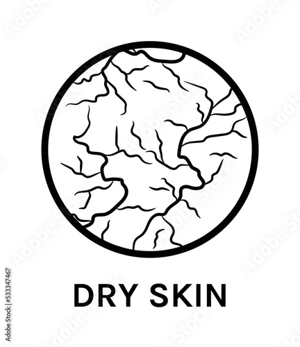 Dry Skin. Icon. Skin Problem. Close up of Dehydrated Unhealthy Skin. Flat Black White color. White background. Vector illustration for Beauty Cosmetic Design.