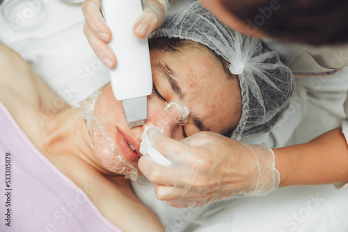 Ultrasonic cosmetic scrubber. Facial cavitation procedure. Salon skin care procedure. Professional hardware peeling. Acne removal. contaminated person