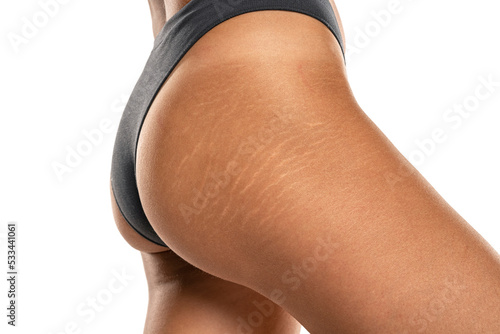 Female tanned hips with a stretch marks and cellulite on white background.