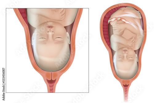 Detailed medical illustration of a baby in the womb. Fetus in Utero. Pregnancy