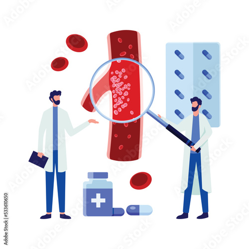 Medical Diagram of Deep Vein Thrombosis at leg area. Illustration about abnormally of blood floow.
