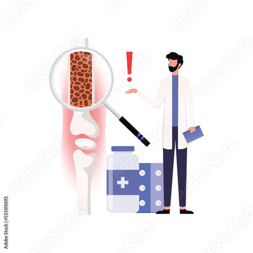 Medical Diagram of Deep Vein Thrombosis at leg area. Illustration about abnormally of blood floow.