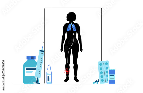 Pulmonary embolism disease