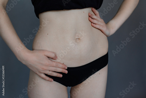 Naked woman in black underwear hide by hands stretch marks on flat belly, gray background. Scars on body after pregnancy, weight loss, childbirth. Imperfections of figure, skin care, body positive