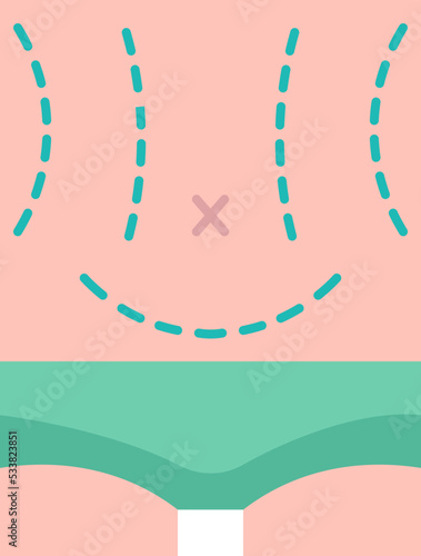 abdominoplasty line icon