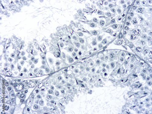 Histology of human tissue, show epithelial tissue and connective tissue with microscope view from laboratory (not Illustration Designation)