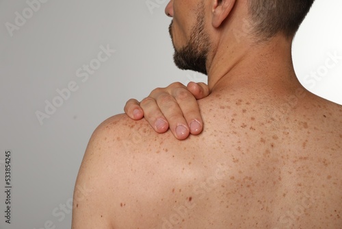 Closeup of man`s body with birthmarks on light grey background, back view photo