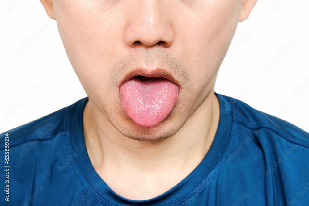 Close-up of a young man. He sticks his tongue out of his mouth to show his tongue. health and medical concepts Close-up of a young man. He sticks his tongue out of his mouth to show his tongue. health and medical concepts