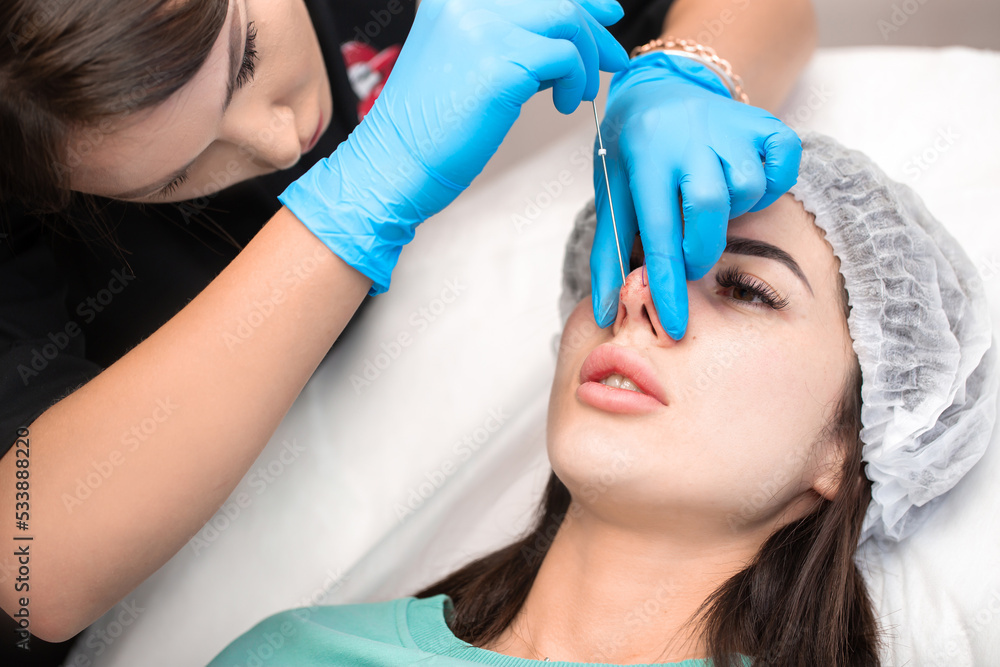 Cosmetic procedure for nonsurgical rhinoplasty. The beautician inserts