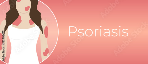 Psoriasis Illness Background Illustration with Woman with Red Skin