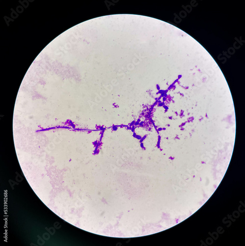 Obraz na płótnie Budding yeast cells with pseudohyphae in urine sample on wright gimsa stain.