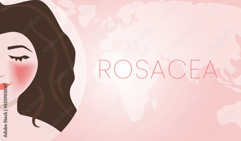 Beautiful Rosacea Skin Illness Background Illustration Design