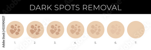 Dark Spots Removal Illustration with Melasma Fading Steps