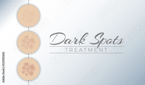 Dark Spots Treatment Illustration Background