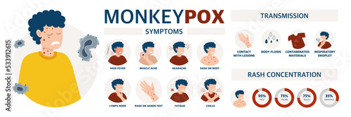 Monkey pox virus Poster to inform about the pandemic and the spread of the disease Images of human methods of spread and symptoms of the disease Vector illustration