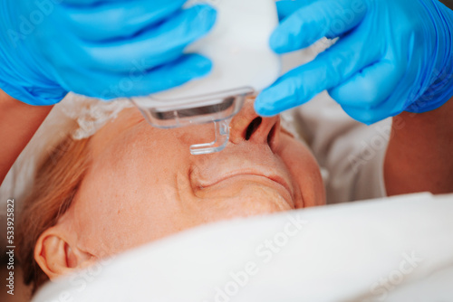 Performing laser resurfacing using an ablative laser on the skin of a patient face in an aesthetic medicine center photo
