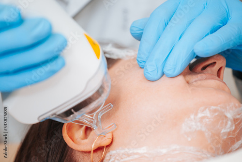 The doctor uses an ablative laser to smooth out fine superficial wrinkles as well as to treat dyspigmentations on the skin of the face, neck and other areas of the body