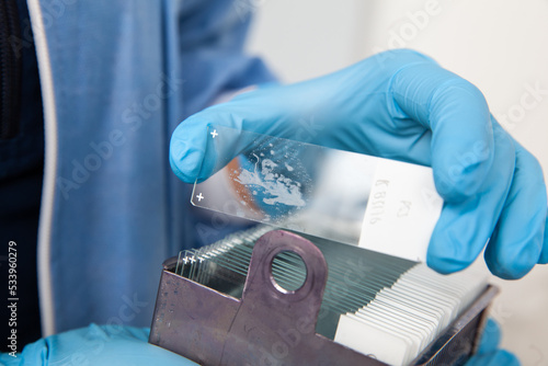 Scientist placing slides with paraffin embedded tissue samples into a slide staining rack. Fluorescent Immunohistochemistry staining of paraffin-embedded tissue sections.