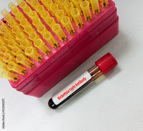 Blood sample for Rickettsia typhi antibody test, diagnosis of rickettsia diseases. Triple antigen test. photo
