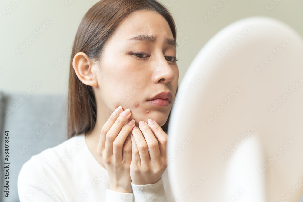 Asian young woman worry about acne on her face after wear face mask.