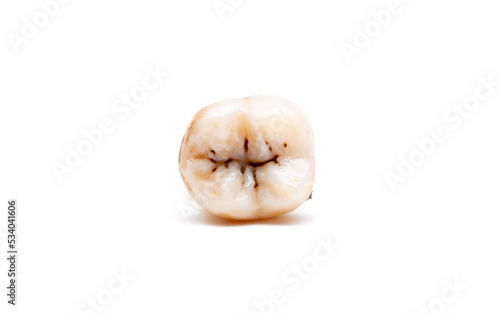 Close-up of a tooth with caries isolated on a white background. Removed wisdom teeth. Sick human teeth. © Vera