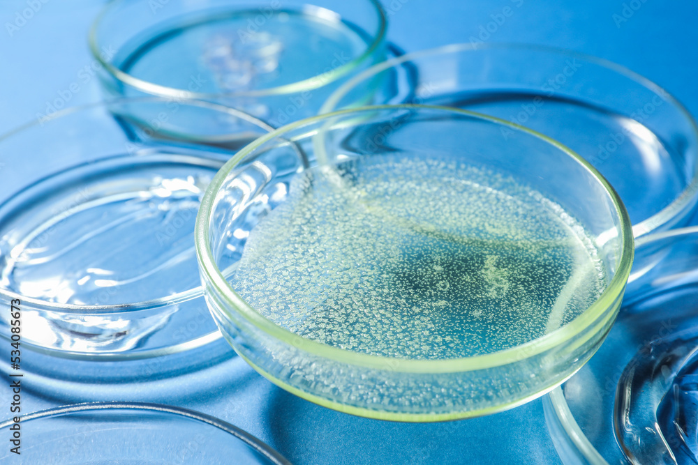 Petri dishes with liquids on blue background, closeup