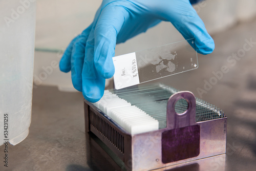 Photography Scientist placing slides with paraffin embedded tissue samples into a slide staining rack