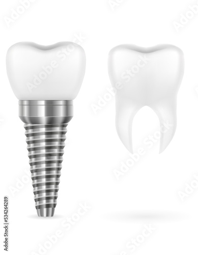 metal human tooth implant vector illustration