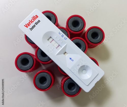 Rapid test cassette or device for Varicella zoster virus test, herpes virus that causes chickenpox. human herpesvirus 3. photo