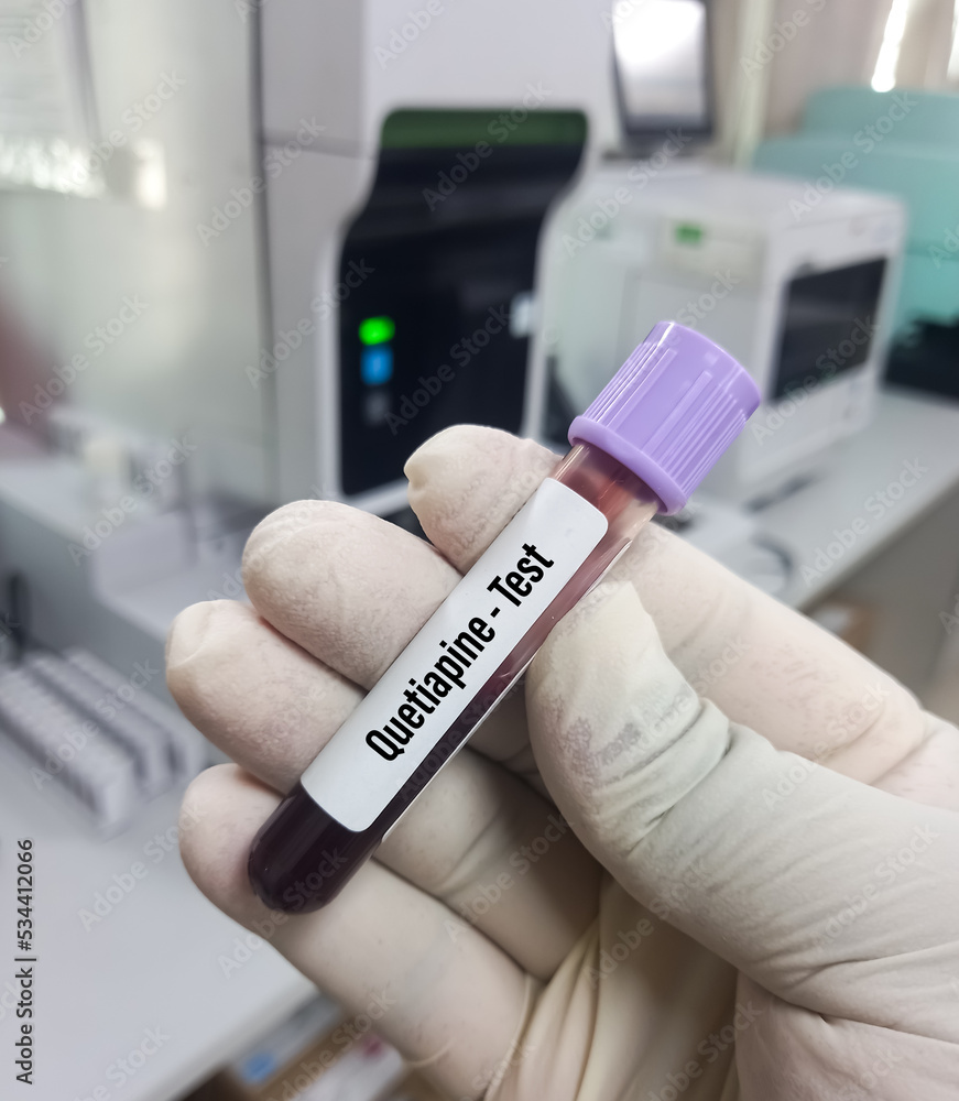 Blood test sample for Quetiapine test, seroquel blood drug test, psychiatric medication therapy. Blood test sample for Quetiapine test, seroquel blood drug test, psychiatric medication therapy.