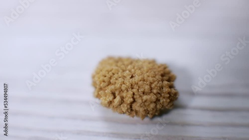 Close-up of a human kidney stone under magnifying glass. An oxalate stone extracted from a human kidney. photo