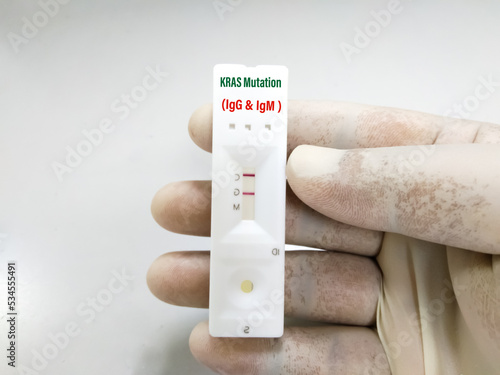 Rapid test cassette for KRAS mutation test for lung cancer. Showing positive result