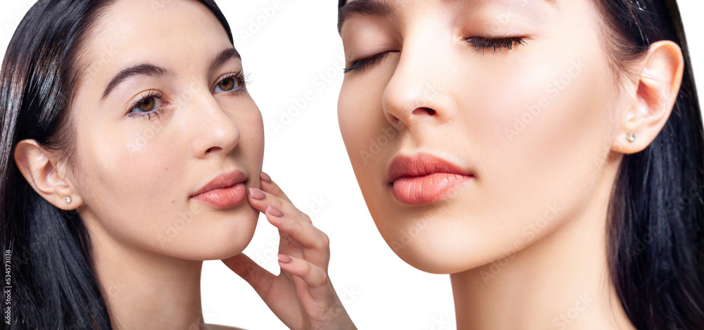 Young woman before and after acne treatment and retouch. Young woman before and after acne treatment and retouch.