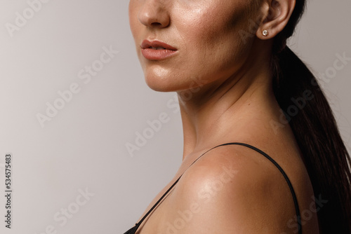 Obraz na płótnie close-up girl with sweaty skin on her face and excessive oily sheen, excessive s