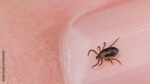 Male deer tick on nail of human finger detail. Ixodes ricinus. Closeup of small mite. Parasite and pink skin of fingertip. Risk of tick-borne diseases transmission as encephalitis or Lyme borreliosis.