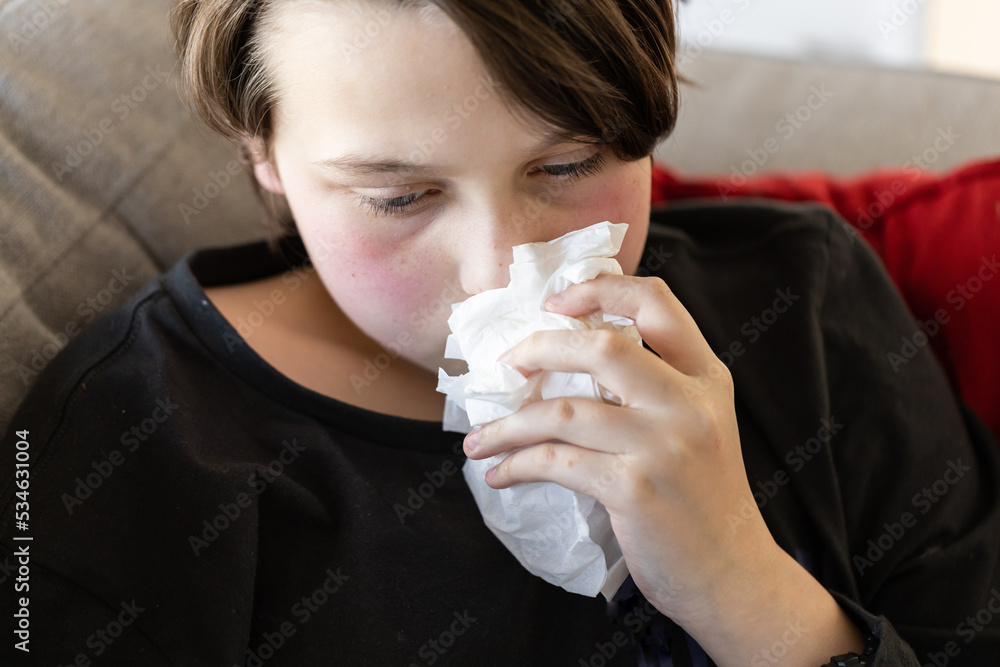 An unwell sick preteen boy lying on a couch holding tissues to his nose, his cheeks are red from a fever