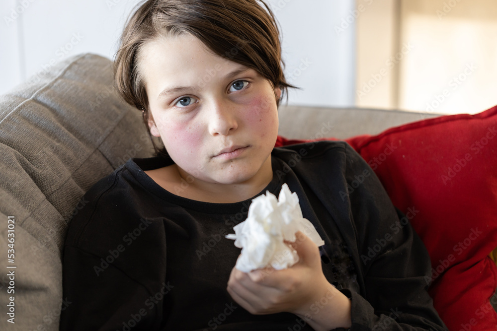 An unwell sick preteen boy lying on a couch looking at the camera