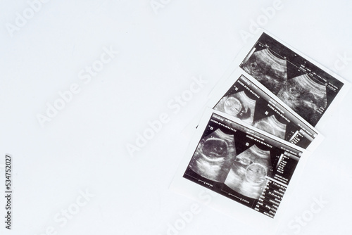 negative space ultrasound sheet on white background