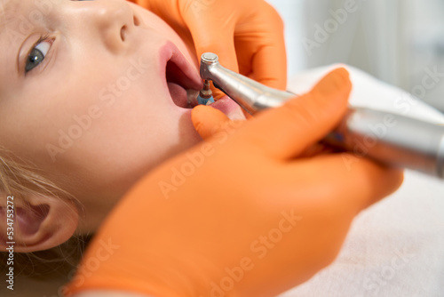Close-up of a dental drill in a child's mouth