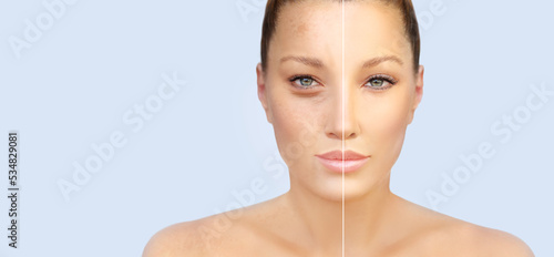 Ageing skin ,internal and external causes of skin aging, signs of skin aging photo