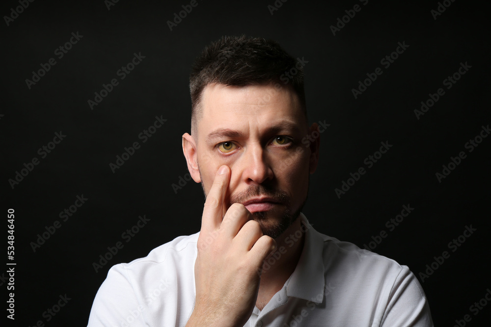 Man checking his health condition on black background. Yellow eyes as symptom of problems with liver Man checking his health condition on black background. Yellow eyes as symptom of problems with liver
