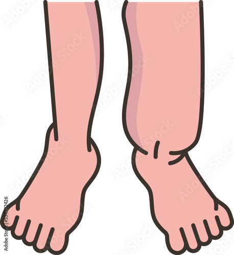 swollen icon