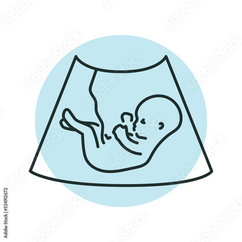 Ultrasound embryo color line illustration