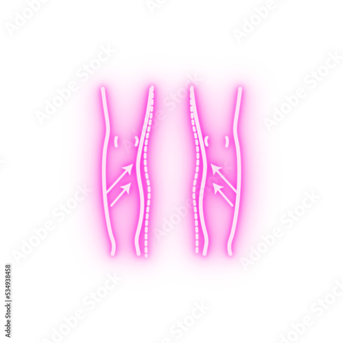 paget's correction woman neon icon